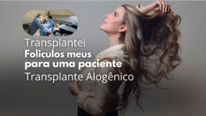Dra Thalita Carlesso -Transplante Capilar
