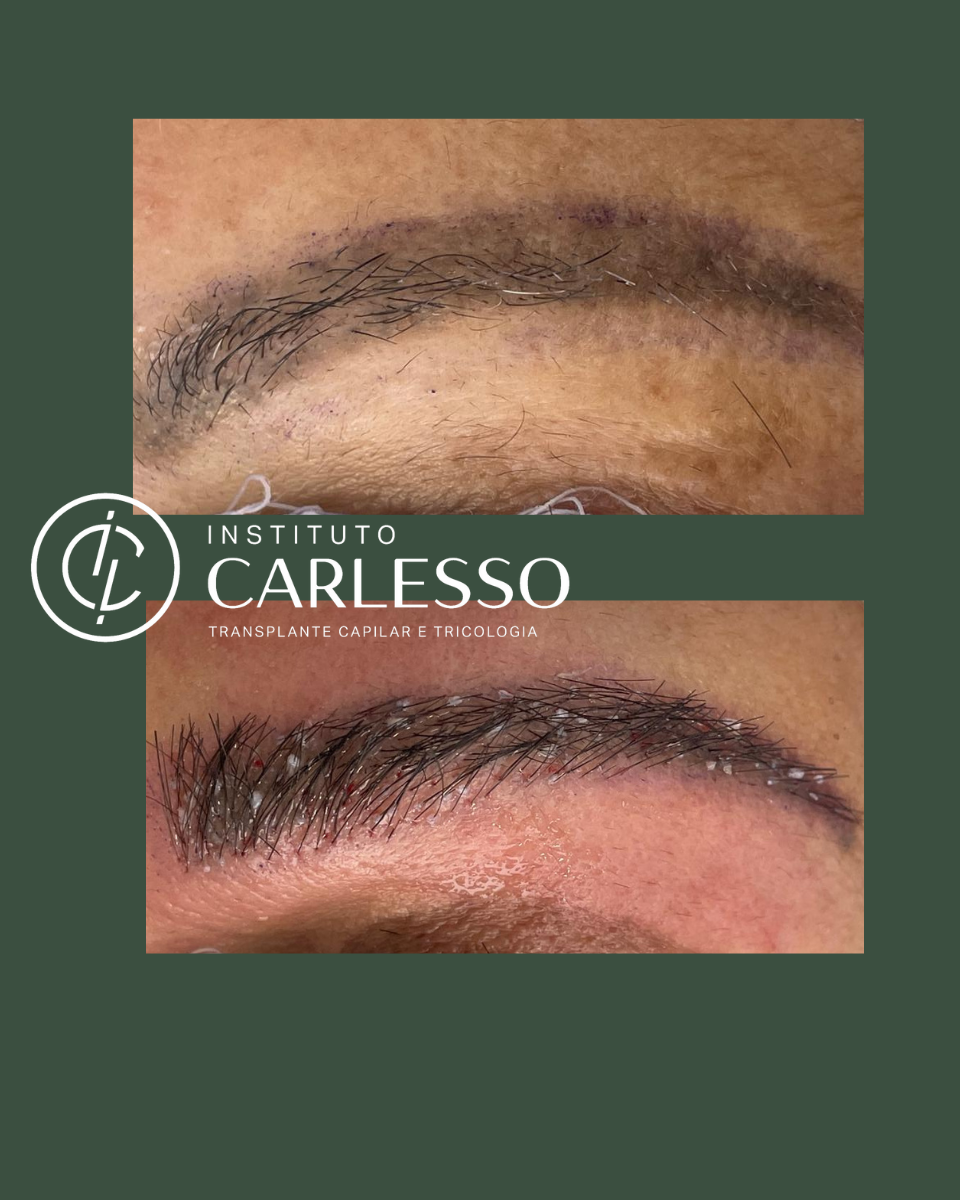 Fotos google 960 x 1.200 (7) (1)