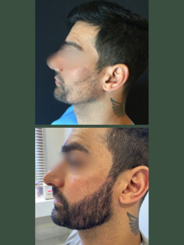 44e5de3c-c849-4761-9e28-aeb35cc763de